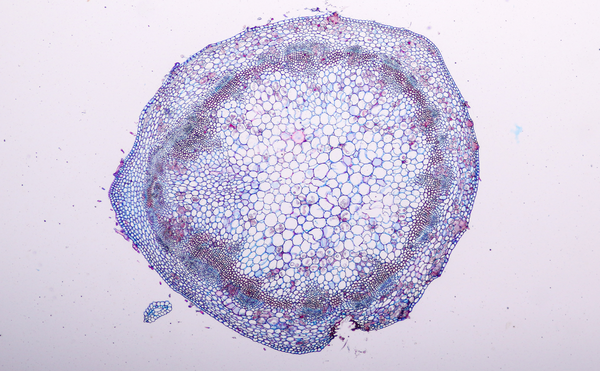 Coccidia under a microscope.