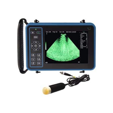 GOYOJO Ultrasound Scanner