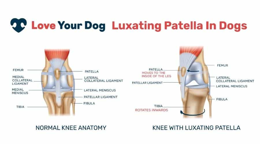 Patella Luxation chart
