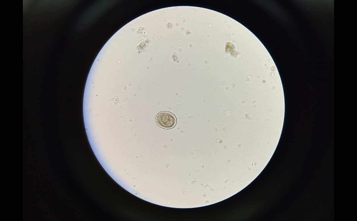 Roundworm under microscope.