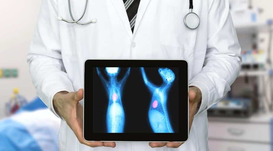 Vet showing tumor on xray screen.