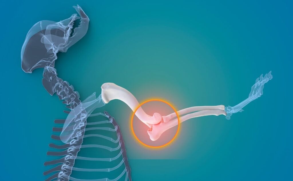 Dog elbow Xray.