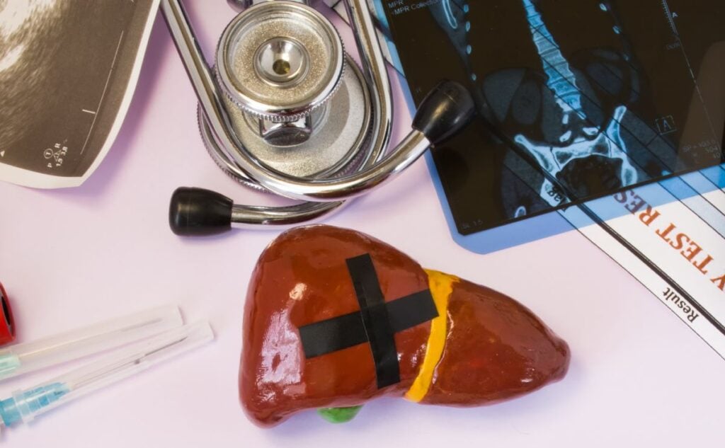 Fake dog liver with test results.