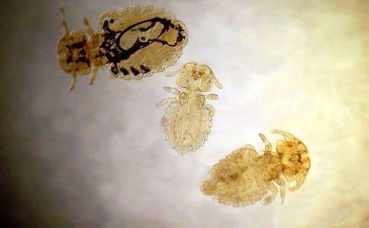 Lice up close under microscope.