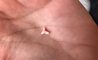 Puppy's premolar tooth in palm of hand