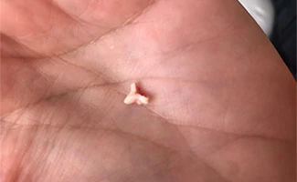 Puppy's premolar tooth in palm of hand